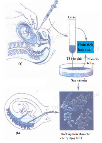 Hình bên dưới mô tả về các biện pháp sàng lọc trước sinh ở người