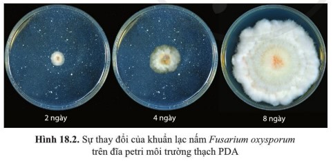 Quan sát hình 18.2 và nhận xét sự thay đổi của khuẩn lạc nấm